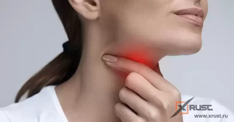Что делать при боли в горле